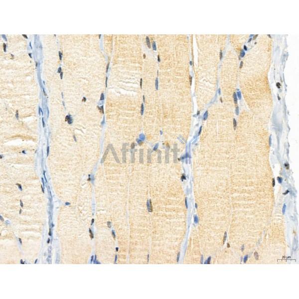 CAPZA1 Antibody - DF12145 at 1/100 staining Rat skin tissue by IHC-P.