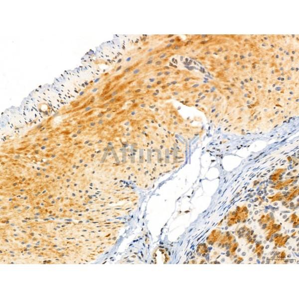 CAPZA1 Antibody - DF12145 at 1/100 staining Rat stomach tissue by IHC-P.