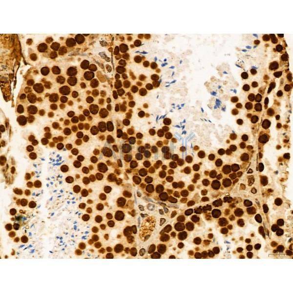 CCP1 Antibody - DF12146 at 1/100 staining Mouse testis tissue by IHC-P.