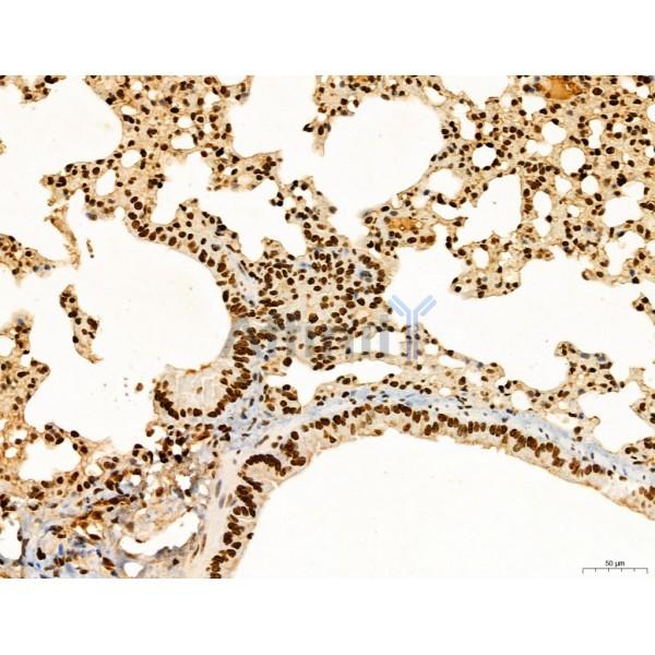 CCP1 Antibody - DF12146 at 1/100 staining Mouse lung tissue by IHC-P.