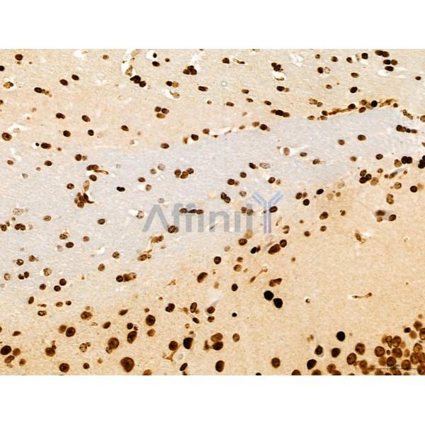 CCP1 Antibody - DF12146 at 1/100 staining Mouse brain tissue by IHC-P.