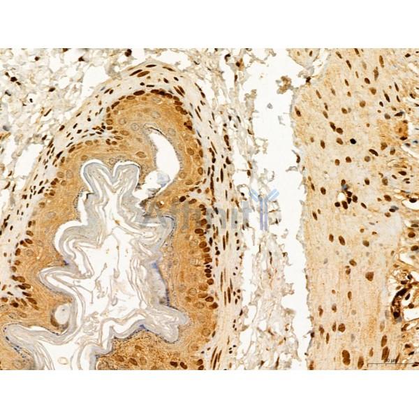 CCP1 Antibody - DF12146 at 1/100 staining Mouse stomach tissue by IHC-P.