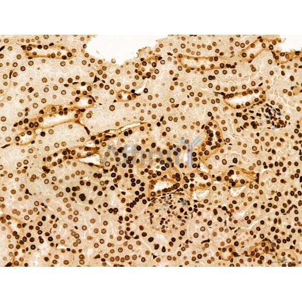 CCP1 Antibody - DF12146 at 1/100 staining Mouse kidney tissue by IHC-P.