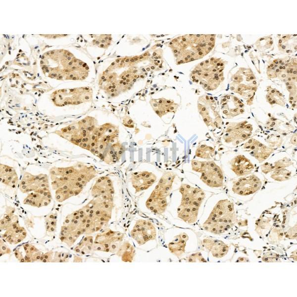 CCP1 Antibody - DF12146 at 1/100 staining Human normal tissues adjacent to gastric cancer by IHC-P.