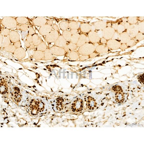 CCP1 Antibody - DF12146 at 1/100 staining Mouse skin tissue by IHC-P.