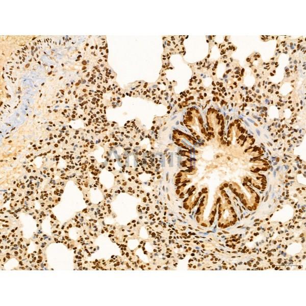CCP1 Antibody - DF12146 at 1/100 staining Rat lung tissue by IHC-P.