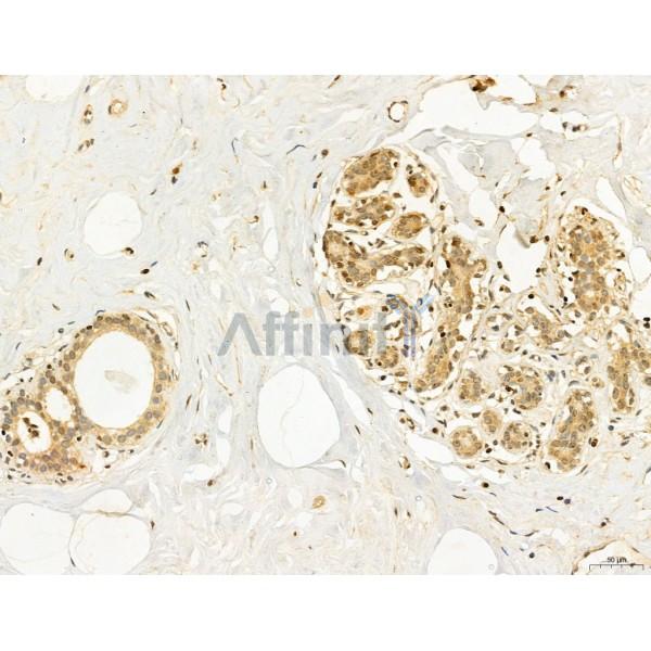 CCP1 Antibody - DF12146 at 1/100 staining Human normal tissues adjacent to mammary cancer by IHC-P.
