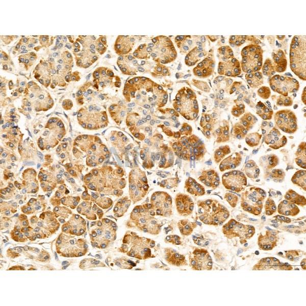 CCP1 Antibody - DF12146 at 1/100 staining Human normal tissues adjacent to pancreatic cancer by IHC-P.
