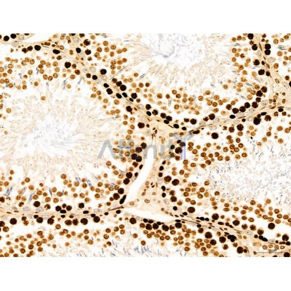 CCP1 Antibody - DF12146 at 1/100 staining Rat testis tissue by IHC-P.
