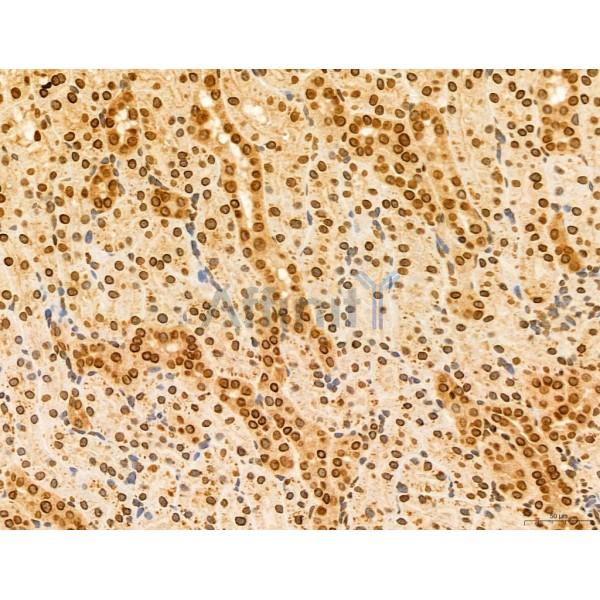 CCP1 Antibody - DF12146 at 1/100 staining Rat kidney tissue by IHC-P.