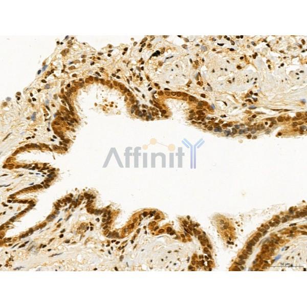 CCP1 Antibody - DF12146 at 1/100 staining Human normal tissues adjacent to lung cancer by IHC-P.