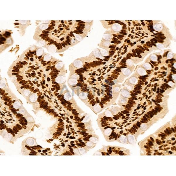 CCP1 Antibody - DF12146 at 1/100 staining Rat colon tissue by IHC-P.