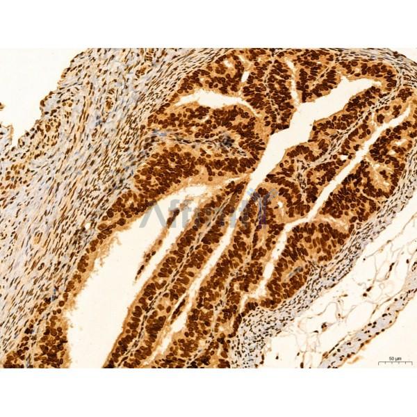 CCP1 Antibody - DF12146 at 1/100 staining Rat ovary tissue by IHC-P.