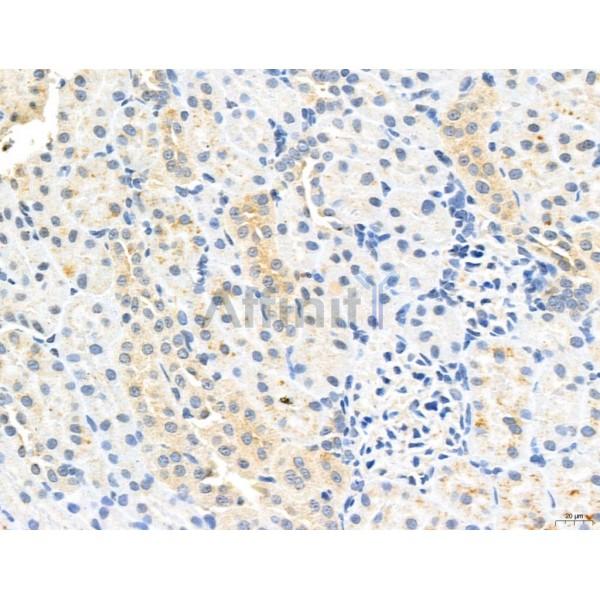 CHMP2A Antibody - DF12147 at 1/100 staining Rat kidney tissue by IHC-P.