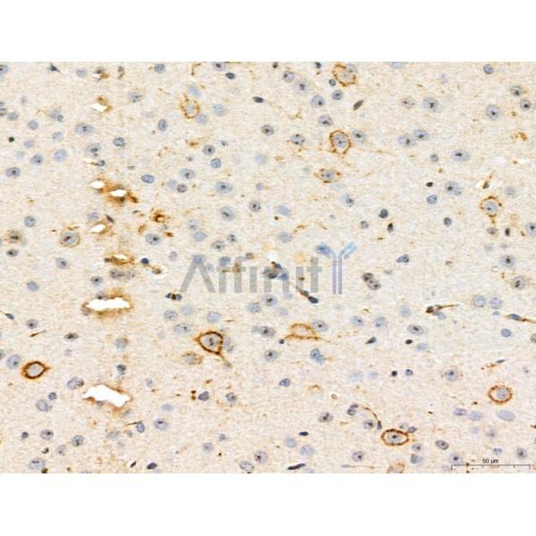 CHMP2A Antibody - DF12147 at 1/100 staining Mouse brain tissue by IHC-P.