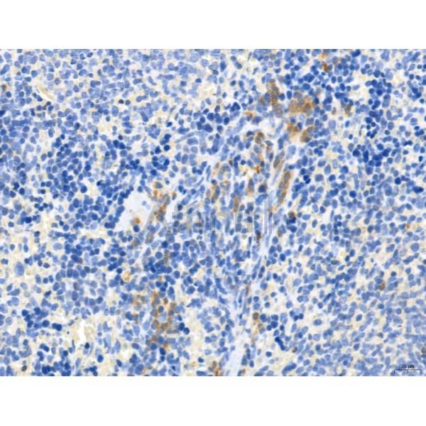 CHMP2A Antibody - DF12147 at 1/100 staining Rat spleen tissue by IHC-P.