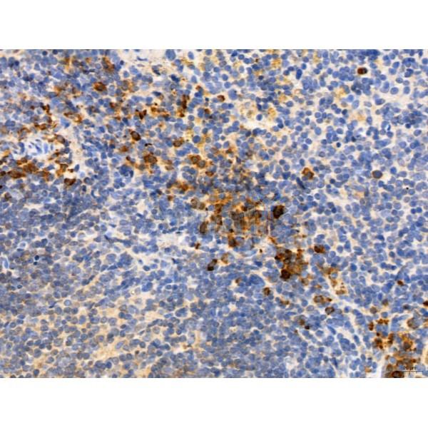 CHMP2A Antibody - DF12147 at 1/100 staining Mouse spleen tissue by IHC-P.