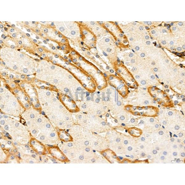 CHMP2A Antibody - DF12147 at 1/100 staining Mouse kidney tissue by IHC-P.
