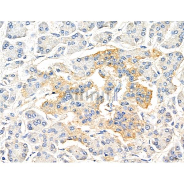 CHMP2A Antibody - DF12147 at 1/100 staining Human normal tissues adjacent to pancreatic cancer by IHC-P.