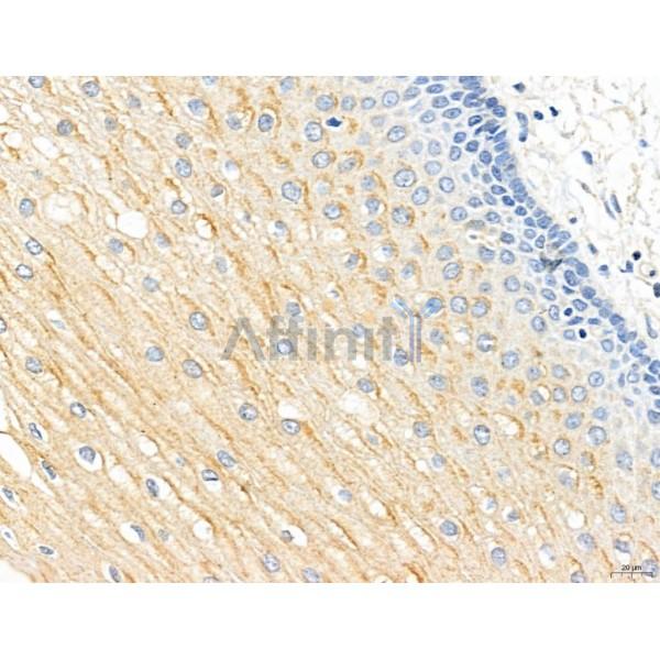 CHMP2A Antibody - DF12147 at 1/100 staining Human normal tissues adjacent to esophageal cancer by IHC-P.