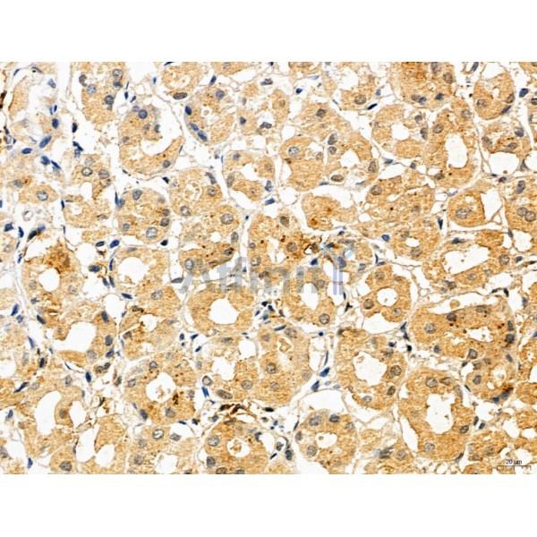 CHMP2A Antibody - DF12147 at 1/100 staining Human normal tissues adjacent to gastric cancer by IHC-P.
