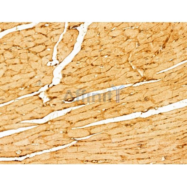 LMOD1 Antibody - DF12160 at 1/100 staining Mouse heart tissue by IHC-P.