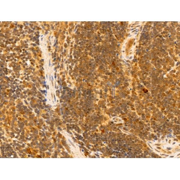 MCM10 Antibody - DF12162 at 1/100 staining Mouse spleen tissue by IHC-P.