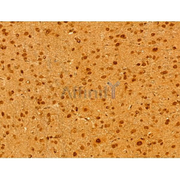 MCM10 Antibody - DF12162 at 1/100 staining Rat brain tissue by IHC-P.