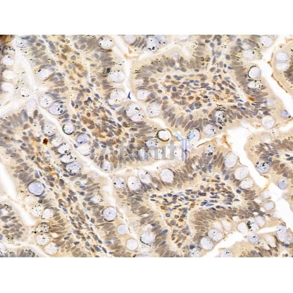 MCM10 Antibody - DF12162 at 1/100 staining Rat colon tissue by IHC-P.
