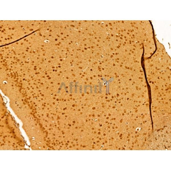 MCM10 Antibody - DF12162 at 1/100 staining Mouse brain tissue by IHC-P.