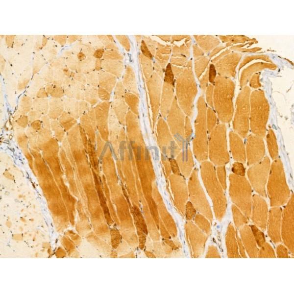 Melanophilin Antibody - DF12163 at 1/100 staining Rat skin tissue by IHC-P.