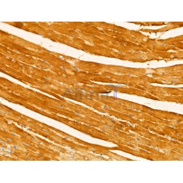 Melanophilin Antibody - DF12163 at 1/100 staining Mouse heart tissue by IHC-P.