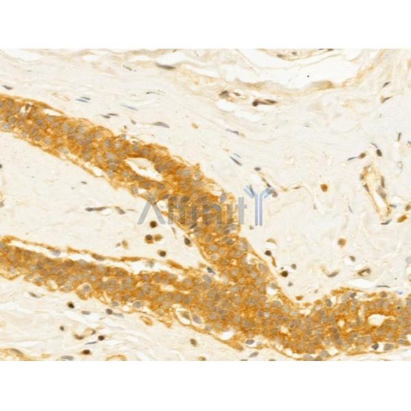 MICAL1 Antibody - DF12164 at 1/100 staining Human normal tissues adjacent to mammary cancer by IHC-P.