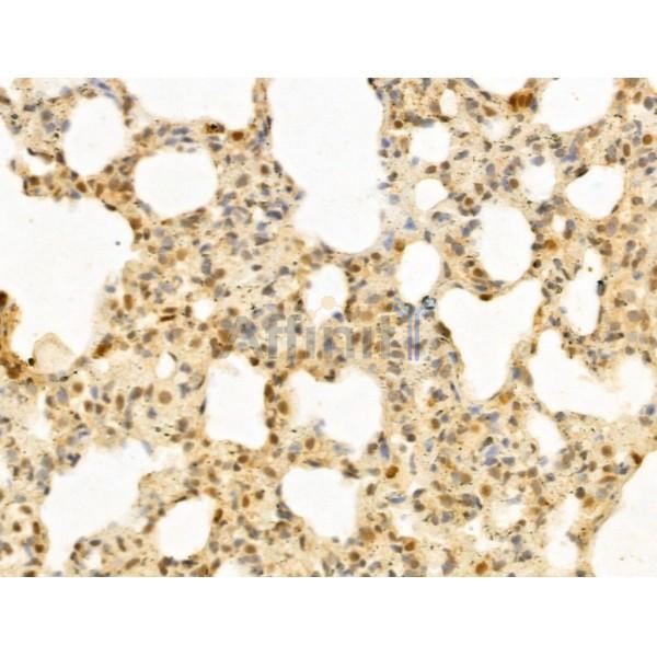 PTPN23 Antibody - DF12169 at 1/100 staining Rat lung tissue by IHC-P.