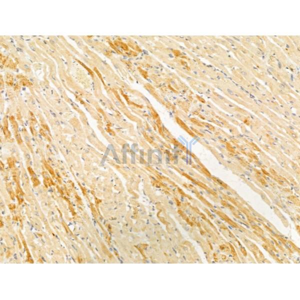 PTPN23 Antibody - DF12169 at 1/100 staining Rat heart tissue by IHC-P.