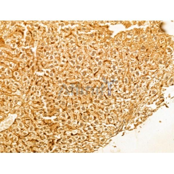 PTPN23 Antibody - DF12169 at 1/100 staining Mouse liver tissue by IHC-P.