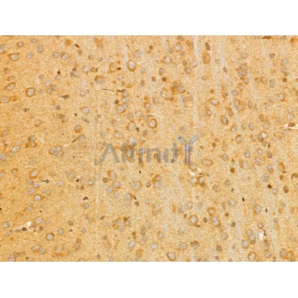 PTPN23 Antibody - DF12169 at 1/100 staining Rat brain tissue by IHC-P.