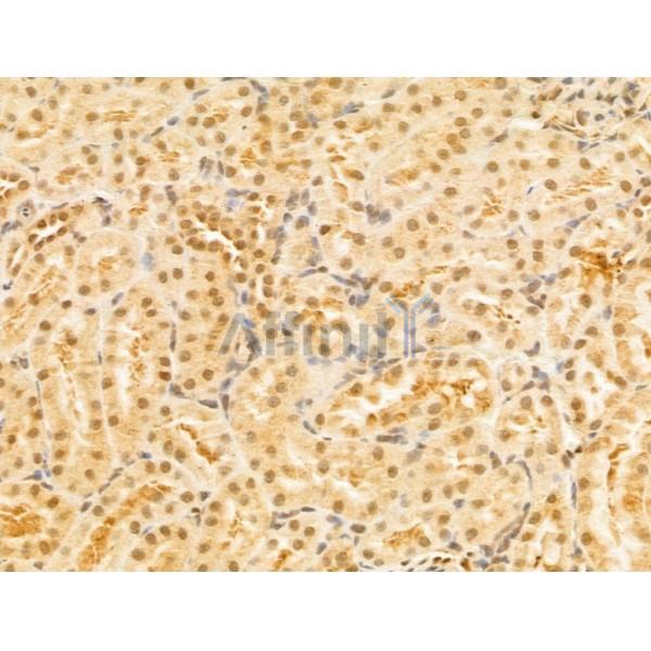 PTPN23 Antibody - DF12169 at 1/100 staining Rat kidney tissue by IHC-P.
