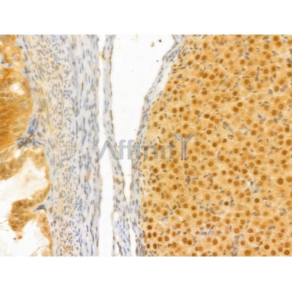 PTPN23 Antibody - DF12169 at 1/100 staining Rat ovary tissue by IHC-P.