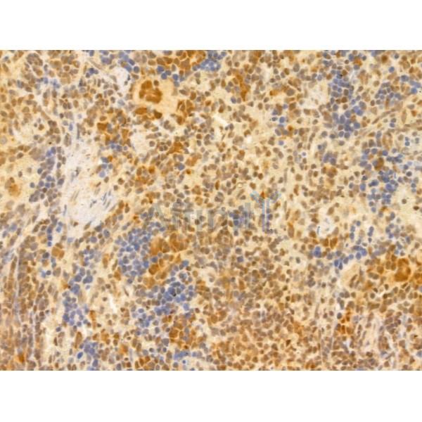 PTPN23 Antibody - DF12169 at 1/100 staining Rat spleen tissue by IHC-P.