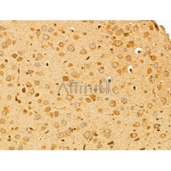 PTPN23 Antibody - DF12169 at 1/100 staining Mouse brain tissue by IHC-P.