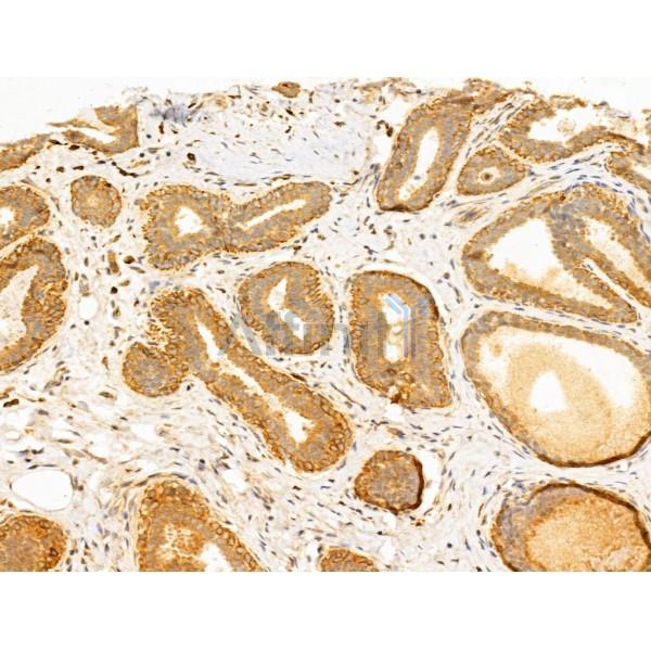RNH1 Antibody - DF12170 at 1/100 staining Human normal tissues adjacent to mammary cancer by IHC-P.