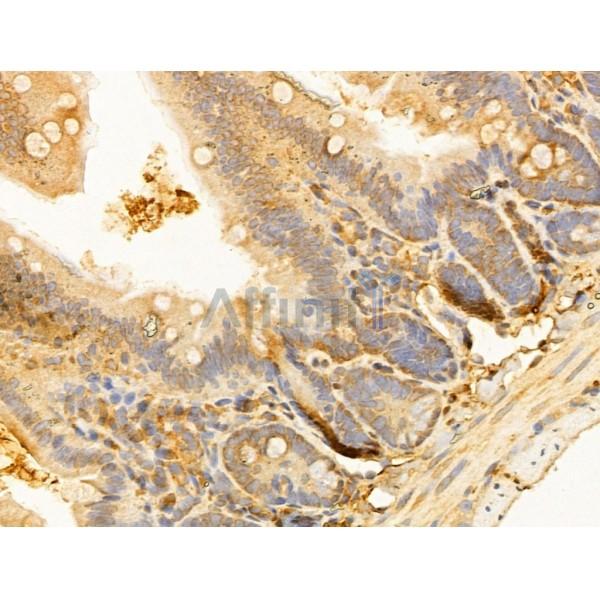 RPGRIP1L Antibody - DF12171 at 1/100 staining Mouse colon tissue by IHC-P.