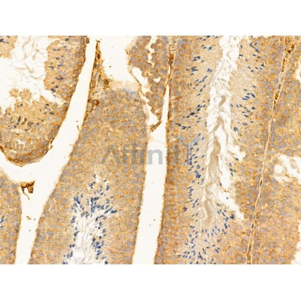 RPGRIP1L Antibody - DF12171 at 1/100 staining Mouse testis tissue by IHC-P.