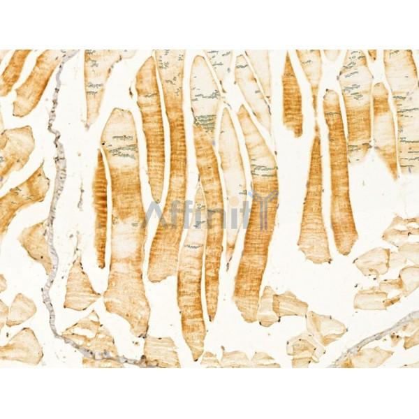 RPGRIP1L Antibody - DF12171 at 1/100 staining Mouse muscle tissue by IHC-P.