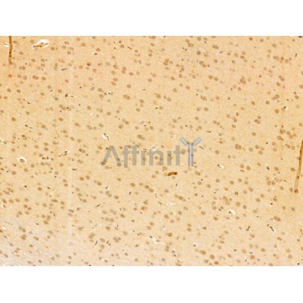 TAF12 Antibody - DF12175 at 1/100 staining Rat brain tissue by IHC-P.