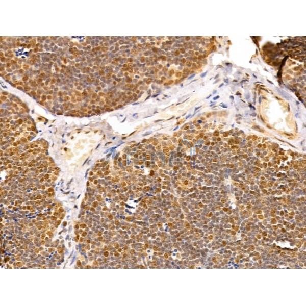 TAF12 Antibody - DF12175 at 1/100 staining Rat thymus tissue by IHC-P.