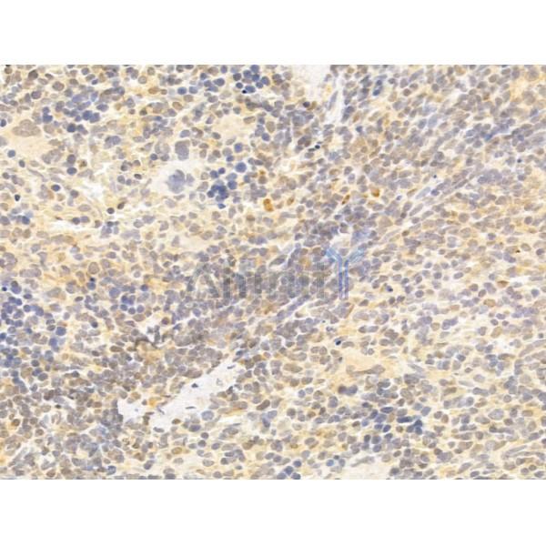 TAF12 Antibody - DF12175 at 1/100 staining Rat spleen tissue by IHC-P.