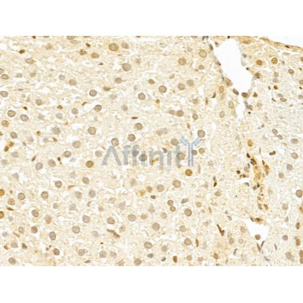 TAF12 Antibody - DF12175 at 1/100 staining Rat liver tissue by IHC-P.
