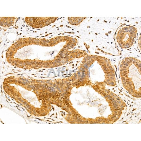 TAF12 Antibody - DF12175 at 1/100 staining Human normal tissues adjacent to mammary cancer by IHC-P.